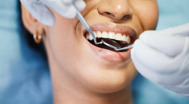 Best Same-Day Emergency Dentist in Taylorvle, IL